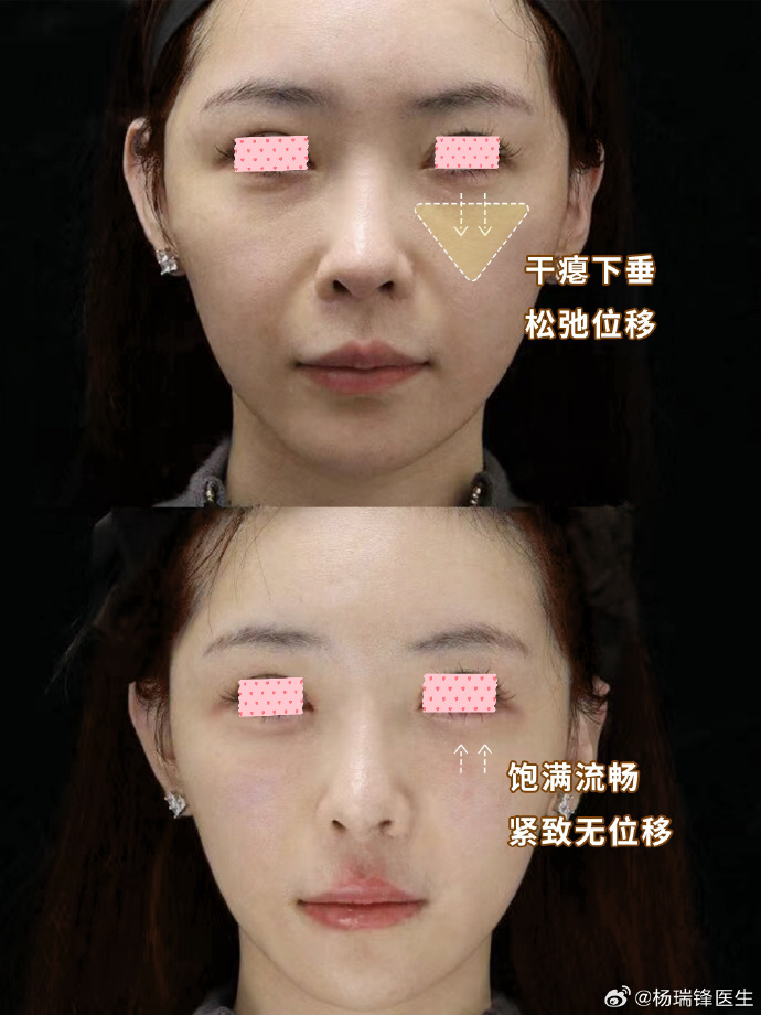 苹果版颜色填充苹果屏幕颜色怎么调